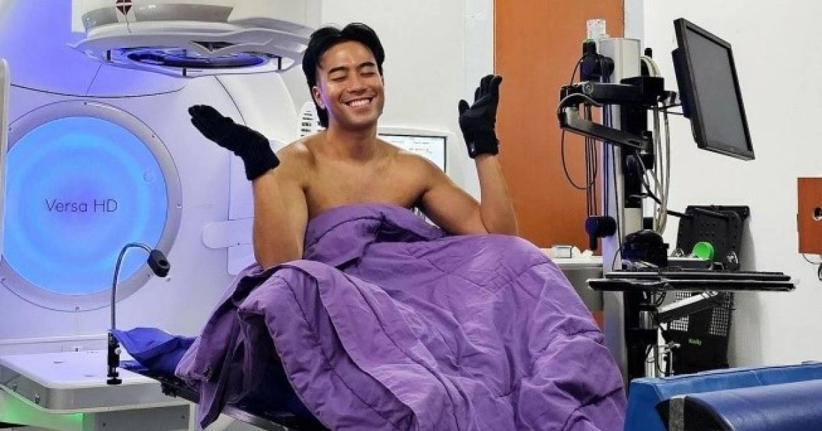 Mengenang Perjuangan Vidi Aldiano: Inilah Fakta Kanker Ginjal Stadium 3 yang Dijuluki 'Silent Killer'