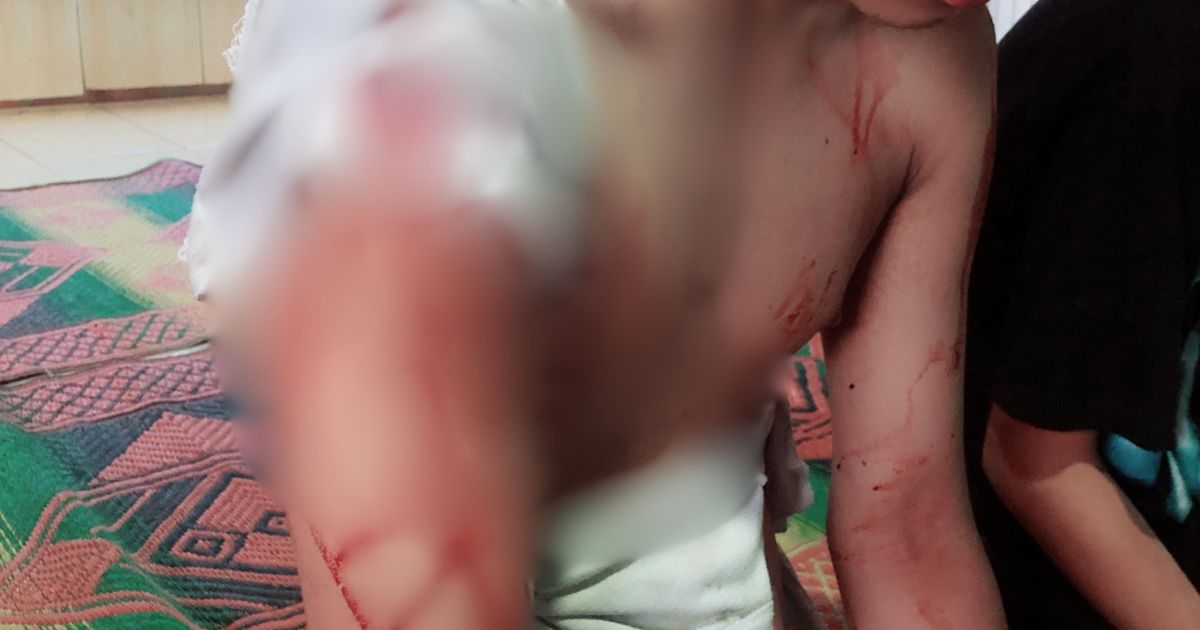 Wisatawan Kemah di Pantai Cibuaya Dibacok Perampok, Kakak Beradik Asal Cianjur Jadi Korban